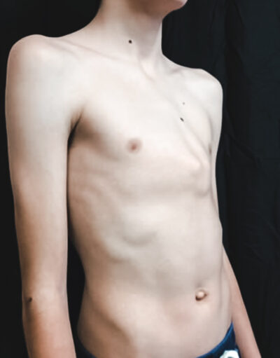 carinatum5-400x511