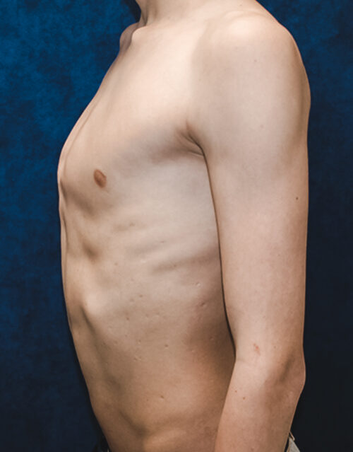 carinatum6-500x639