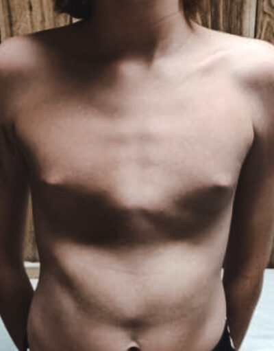 carinatum7-400x511